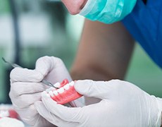 dentist explaining dentures in New Bedford